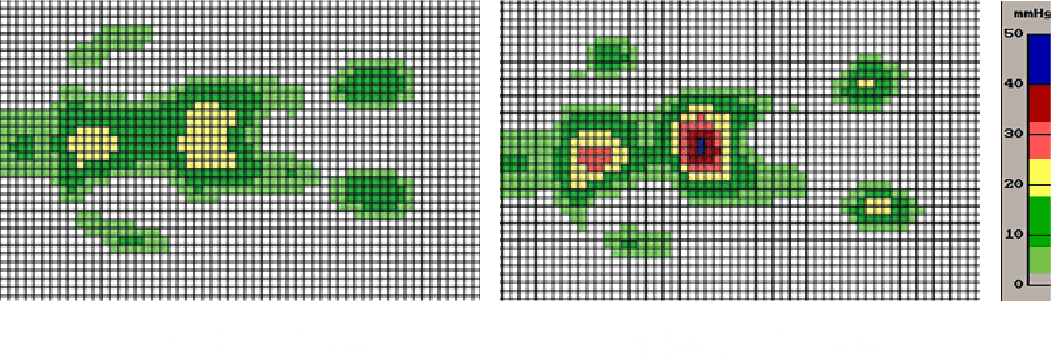 体圧分散 × 寝姿勢保持